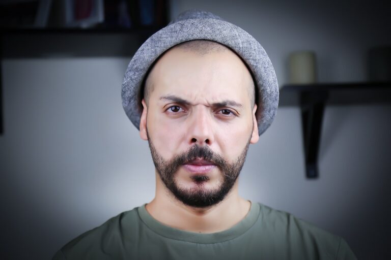 Cover Up The Baldness: Six Ways To Hide Hair Loss Cover Up The Baldness