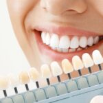 Teeth Whitening Techniques