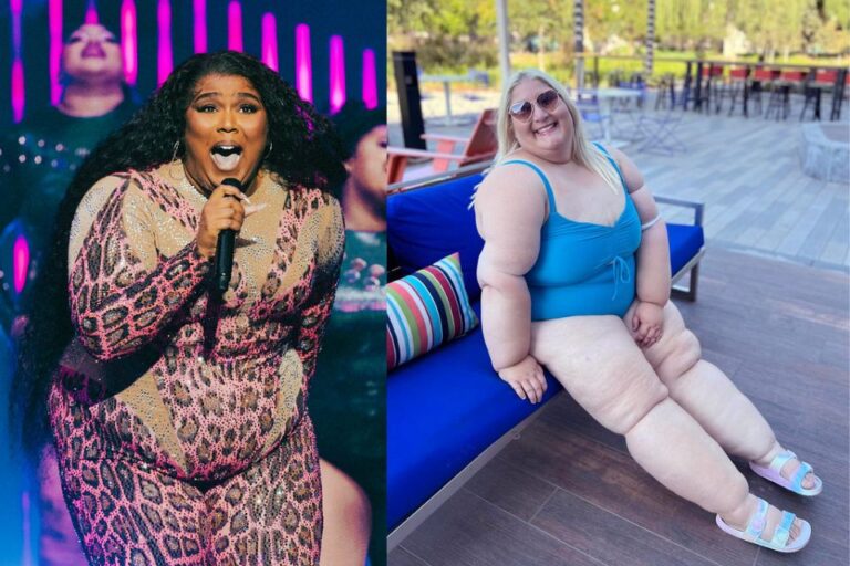 Celebrities With Lipedema: 7 Stars Who Spoke Out About Symptoms & Treatment Celebrities With Lipedema