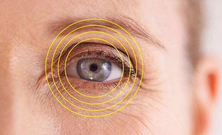 Refractive Surgery Choices